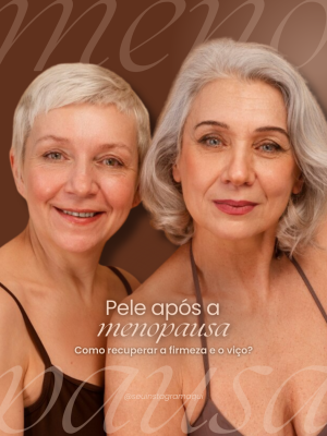 PARTE 3 - ESTÉTICA FACIAL PREMIUM com legenda (1080 x 1350 px) (3)