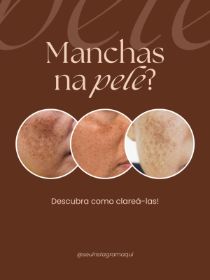 PARTE 3 - ESTÉTICA FACIAL PREMIUM com legenda (1080 x 1350 px)